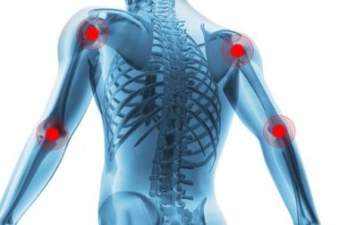 Gelenkverschleiß: Ursachen, Symptome und Behandlung