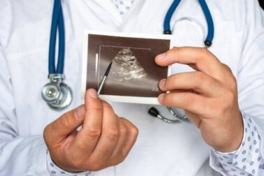 Was ist ein Phäochromozytom und was sind seine Symptome?