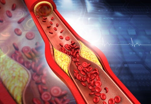 Niedriger HDL-Cholesterinspiegel: Symptome und was du dagegen unternehmen kannst