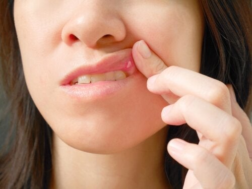 Was ist ein orales Fibrom?