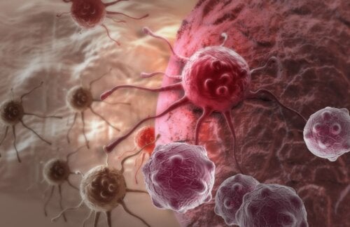 Dostarlimab: Experimentelles Darmkrebsmedikament führt bei allen Studienpatienten zu einer Remission