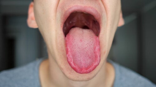 Taube Zunge? Hier findest du 18 möglichen Ursachen