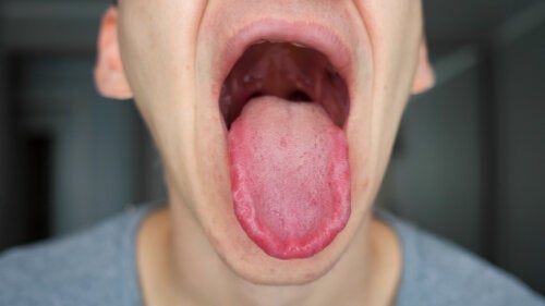 Taube Zunge? Hier sind 18 mögliche Ursachen - Besser Gesund Leben