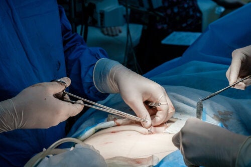 Hauttransplantation: Wann kommt sie zum Einsatz?