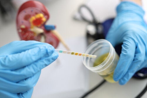 Urobilinogen im Urin: Normalwerte und Ursachen für erhöhte Werte