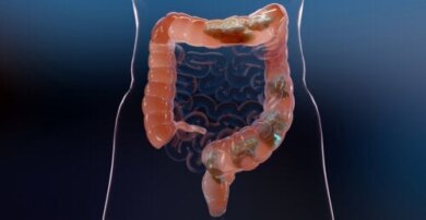 Colon-Hydro-Therapie: Mythen und Fakten, die du wissen musst