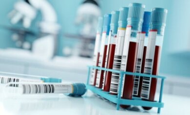 Gesamteiweißtest: Ergebnisse und ihre Bedeutung