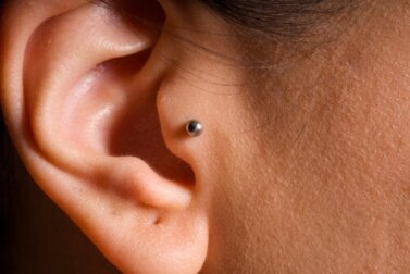 Abstoßung von Piercings: Ursachen, Behandlung und Prävention