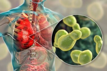 Die 4 gefährlichsten Pilze für unsere Gesundheit laut der WHO