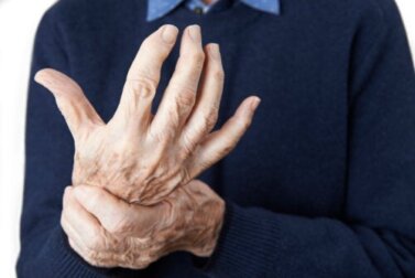 Ernährung und Arthritis: 7 Mythen und nachweislich wirksame natürliche Heilmittel