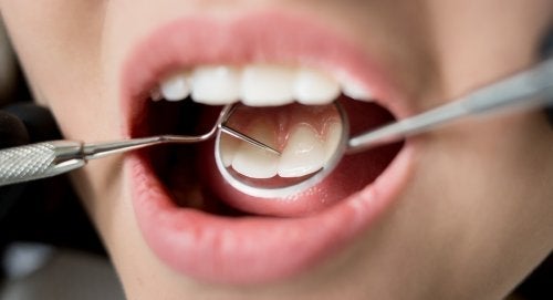 Schlechte Zahnhygiene: 7 Folgen für deine Gesundheit