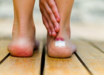 Hautreizung durch Reibung: Pflegemaßnahmen und Behandlung