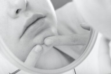 Wie man blinde Pickel loswird