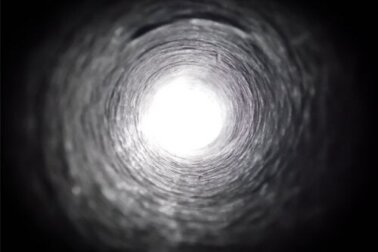 Tunnelblick: Was ist das und wie kann man ihn behandeln?