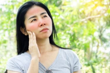 Lichtempfindlichkeit bei Lupus - was tun?