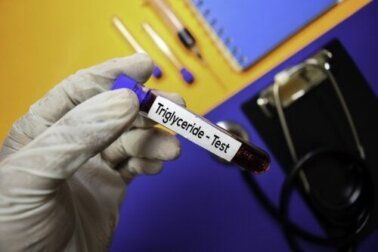 Triglyceridspiegel: Was du wissen solltest!