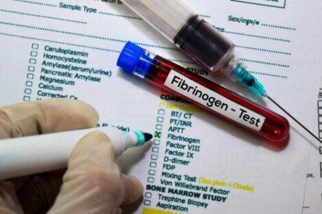 Fibrinogen-Bluttest: Funktionen und Ergebnisse